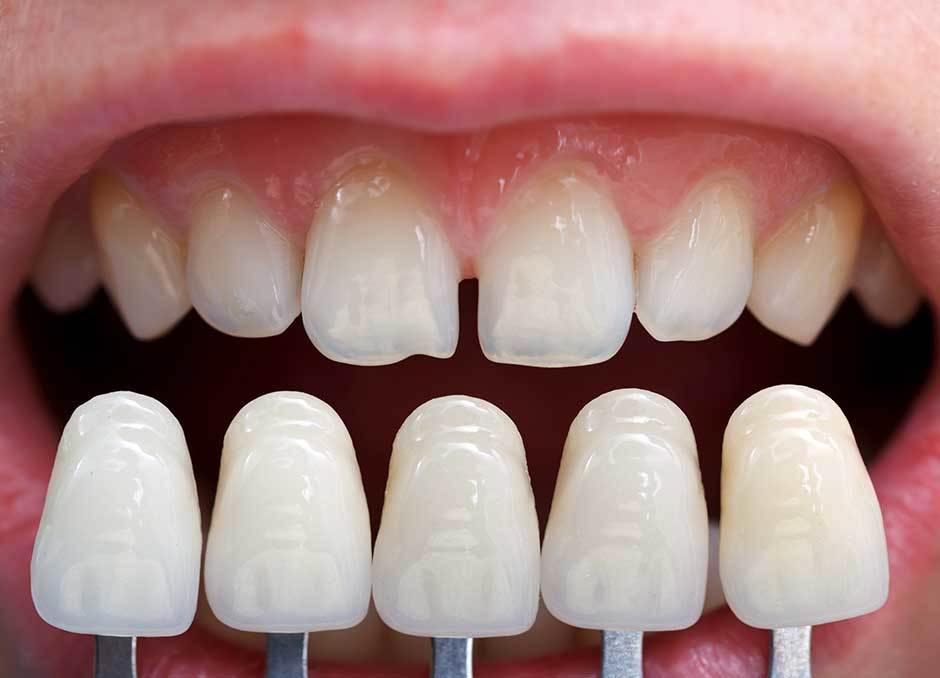 Yuan Tian Dental PLLC
