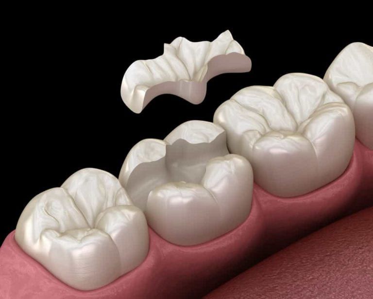 Yuan Tian Dental PLLC